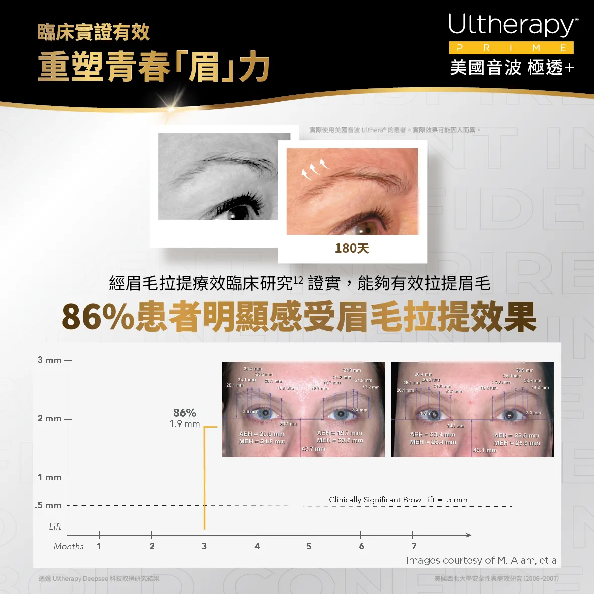 美國音波二代 極透+ 介紹 18
