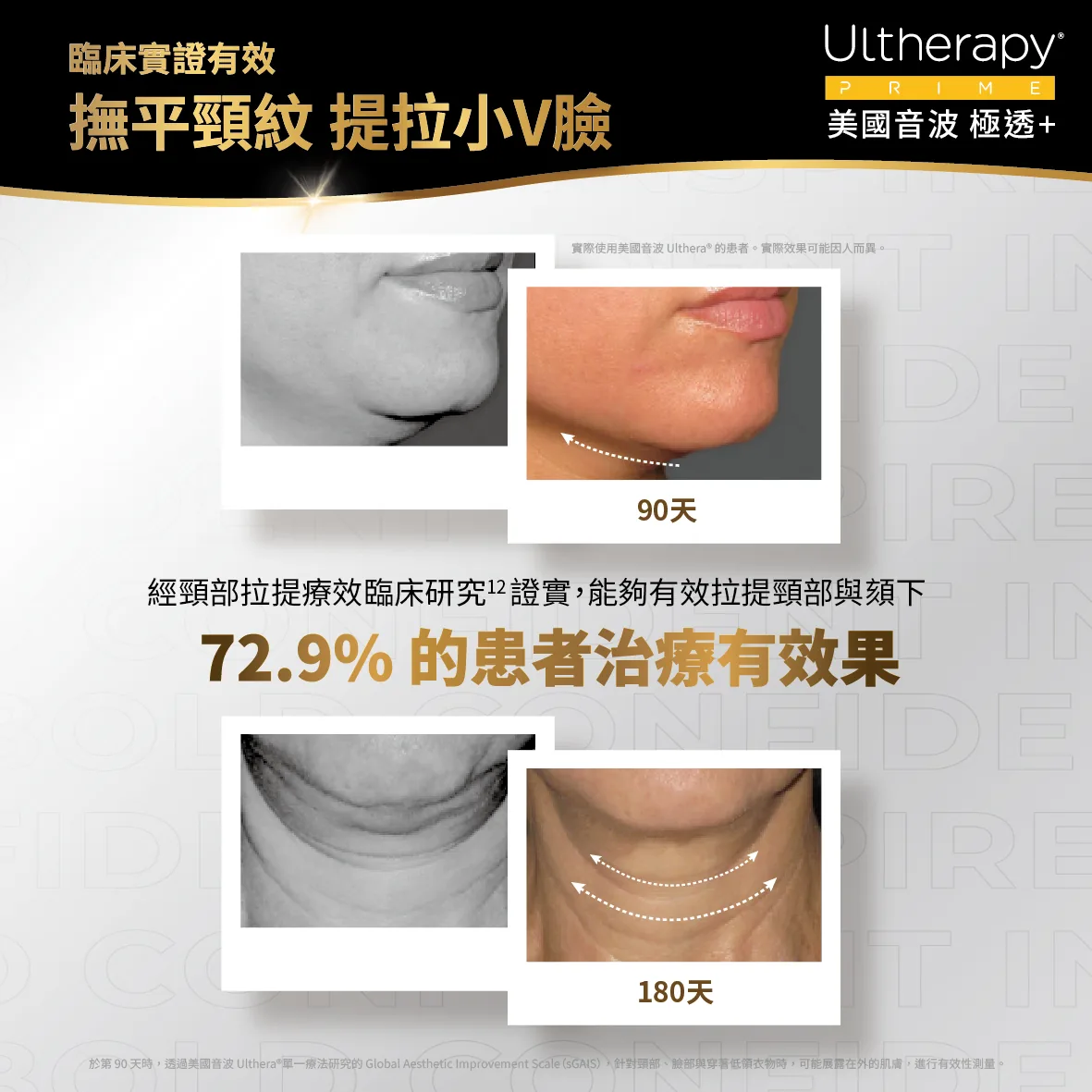 美國音波二代 極透+ 介紹 19