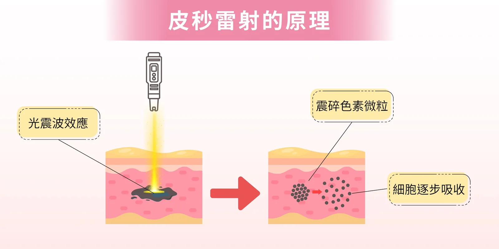 皮秒蜂巢 介紹 2