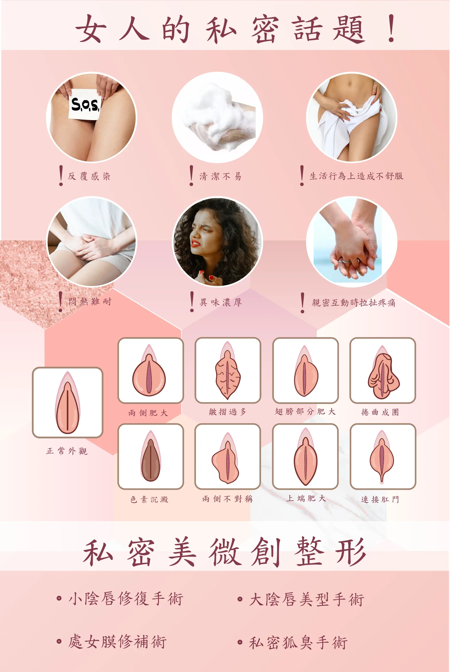 私密處手術