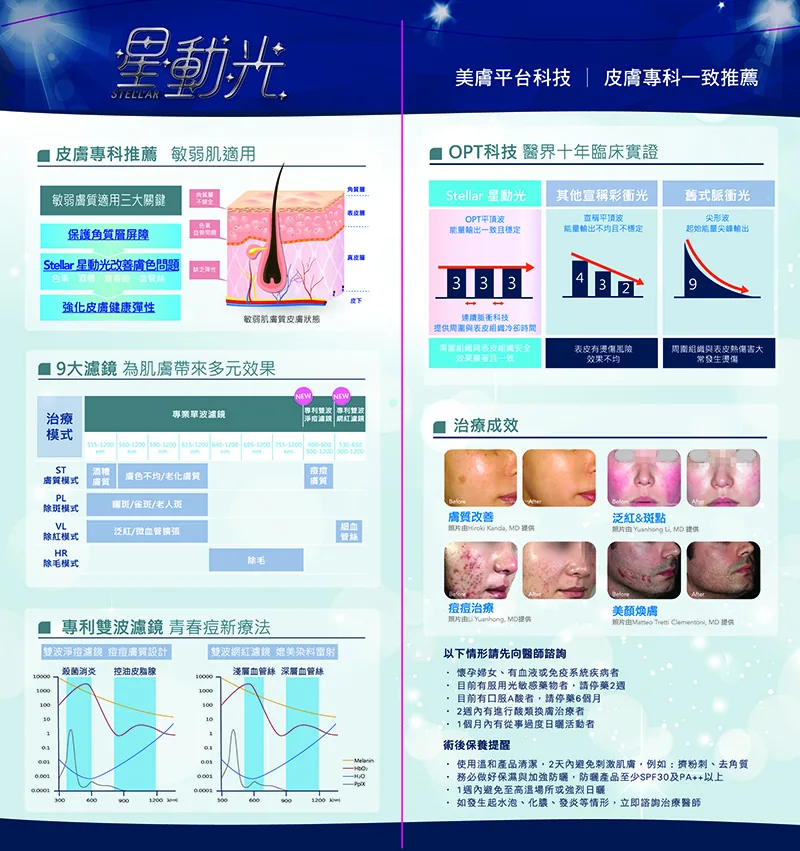 星動光 介紹 4